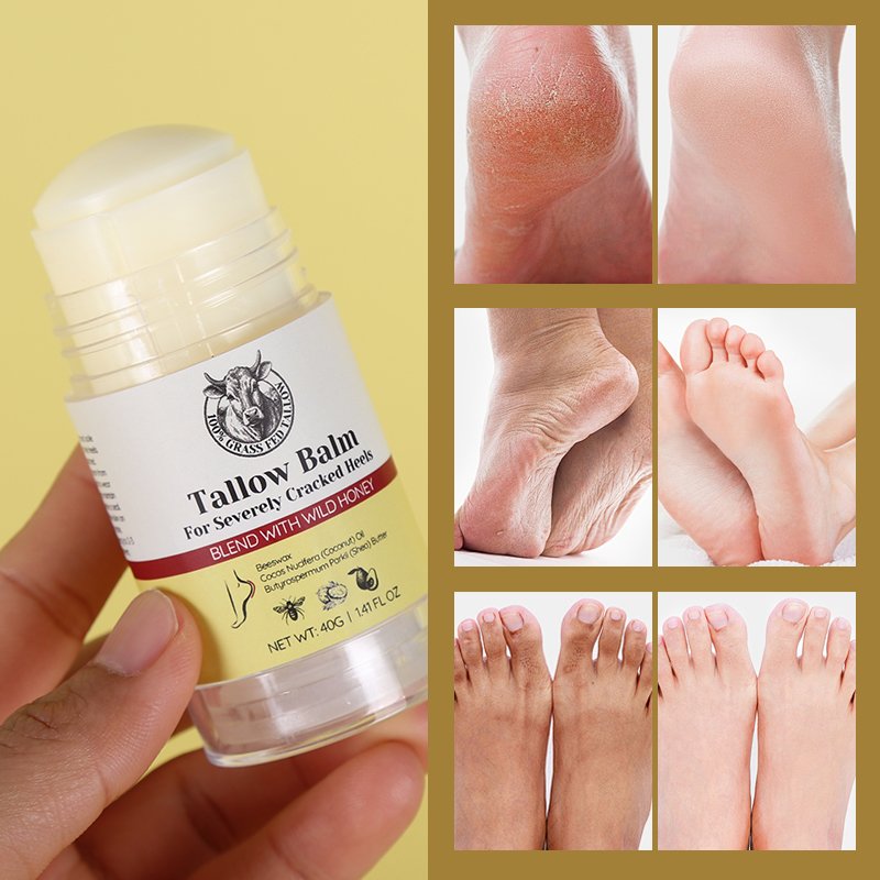 Odm Foot Cream Care Stick Severe Cracked Heel Softener Repair Restoring Whipped Beef Tallow